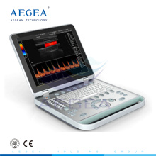 AG-BU005 modelo de doppler do hospital nebook scanner de ultrassom tipo B